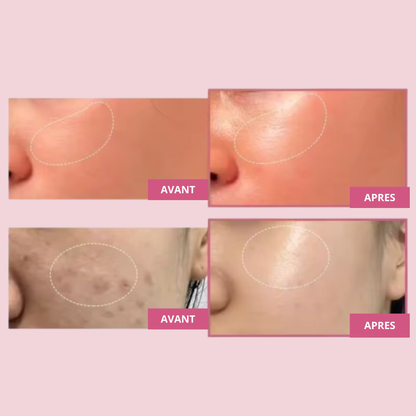 Crème gélée au collagène et à la niacinamide