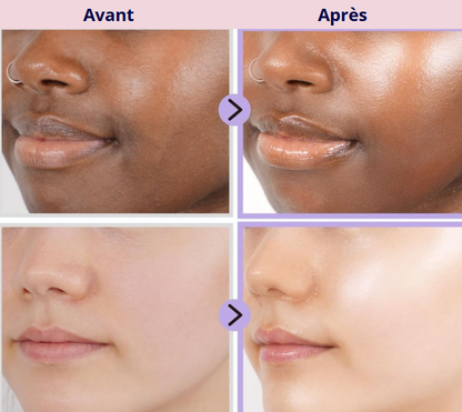 Crème gélée au collagène et à la niacinamide